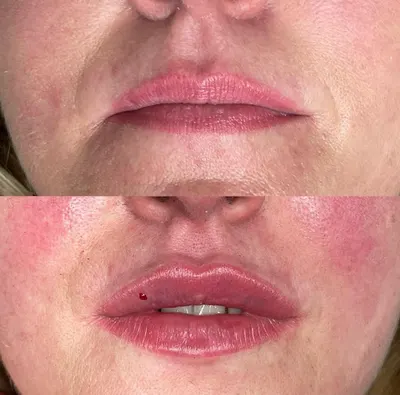 Medycyna Estetyczna Manuela Tamul